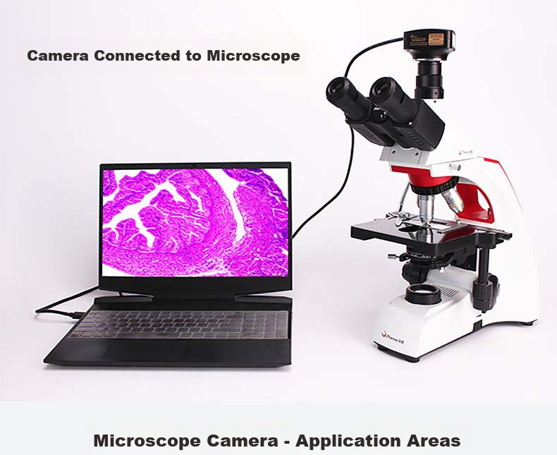 Phenix MC-D500U(C) Microscope Camera, Electronic Eyepiece, Connects to Computer for Photography And Video Recording 10