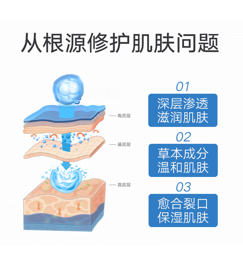 冰王鳄油冻疮消乳膏套装 冻疮膏冻裂膏冻伤膏皲裂膏冬季护手霜 90g