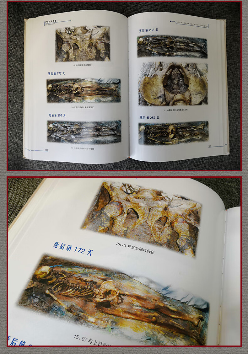 解刨学图鉴全套2本彩图注释法医学专业书籍教材医学生人体解剖图谱 》