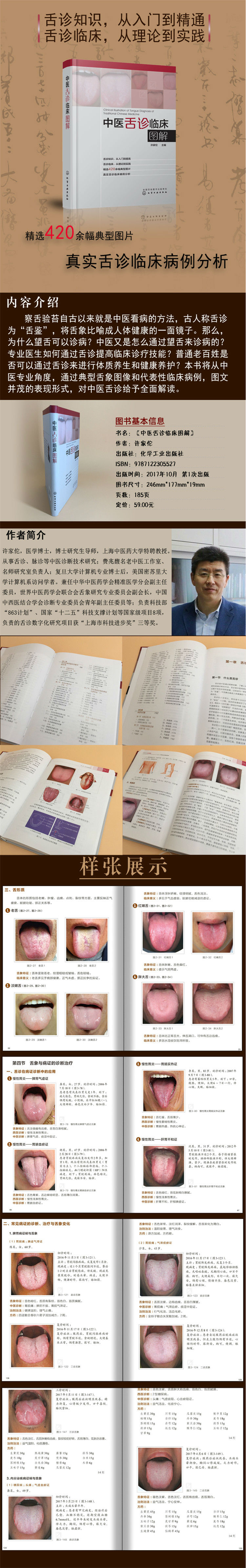 正版中医舌诊临床图解 临床实用舌象图谱400幅典型舌象图舌象的正常与